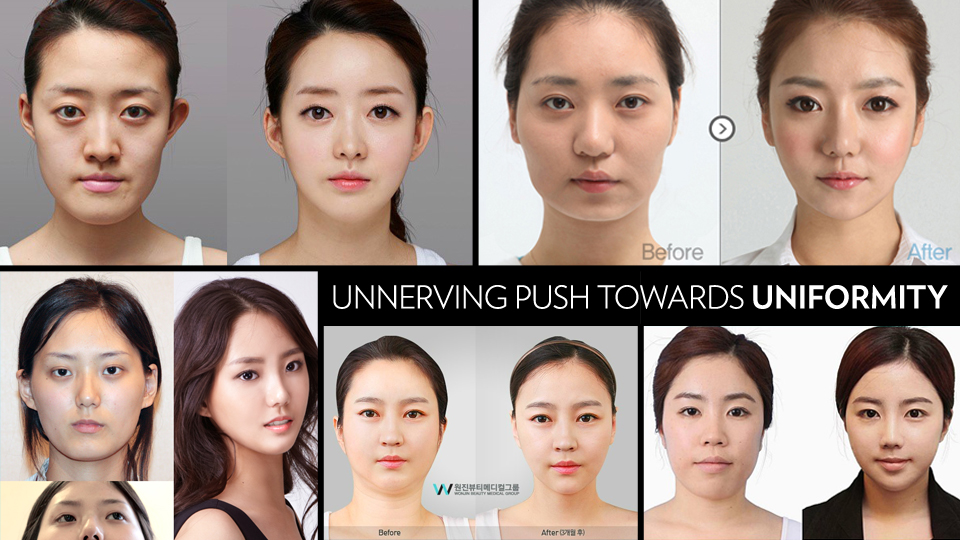 Korea’s obsession with plastic surgery is creating a